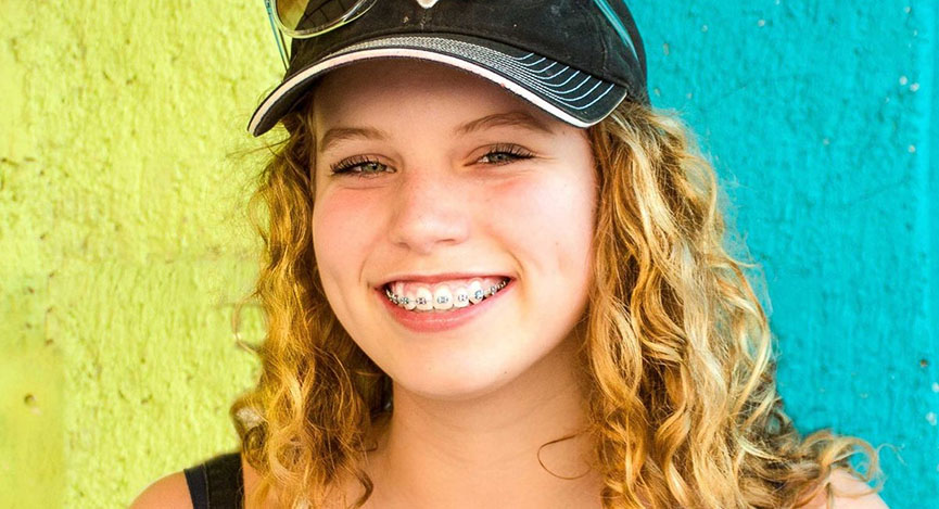 Установка брекетов в Харькове