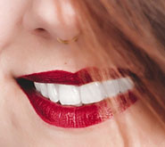 Белоснежная улыбка