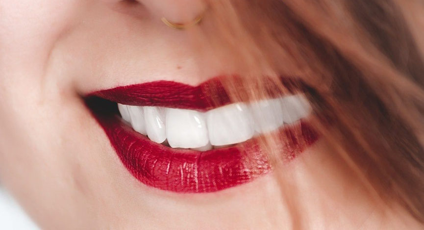 Белоснежная улыбка