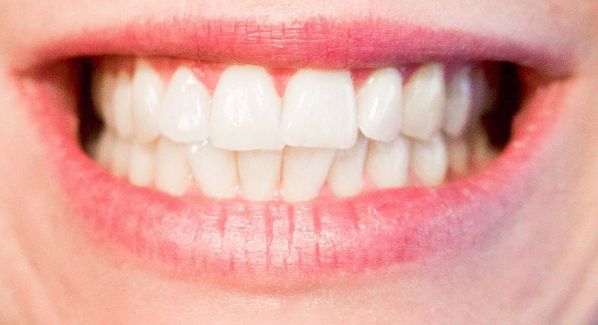 Старение зубов